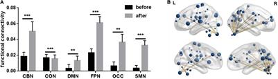 Treatment Enhances Betweenness Centrality of Fronto-Parietal Network in Parkinson’s Patients